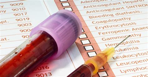 Hepatitis C antibody test: Results and what to expect.